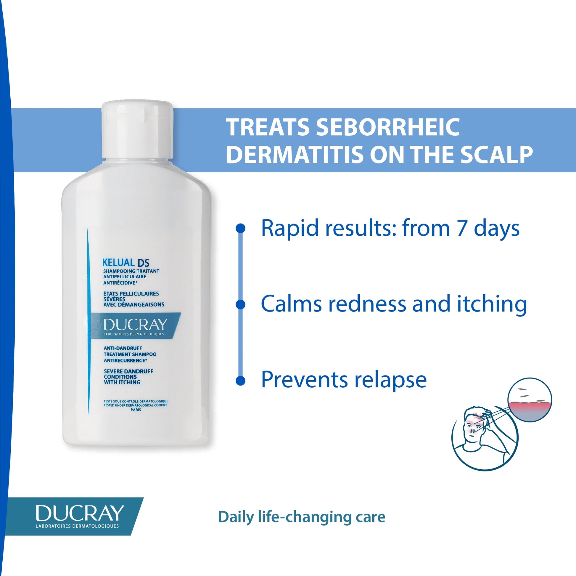 Ducray Kelual DS Anti-Dandruff Shampoo | Treats Seborrheic Dermatitis, Reduces Flaking and Itching, Soothes Sensitive Scalp, Restores Balance-3