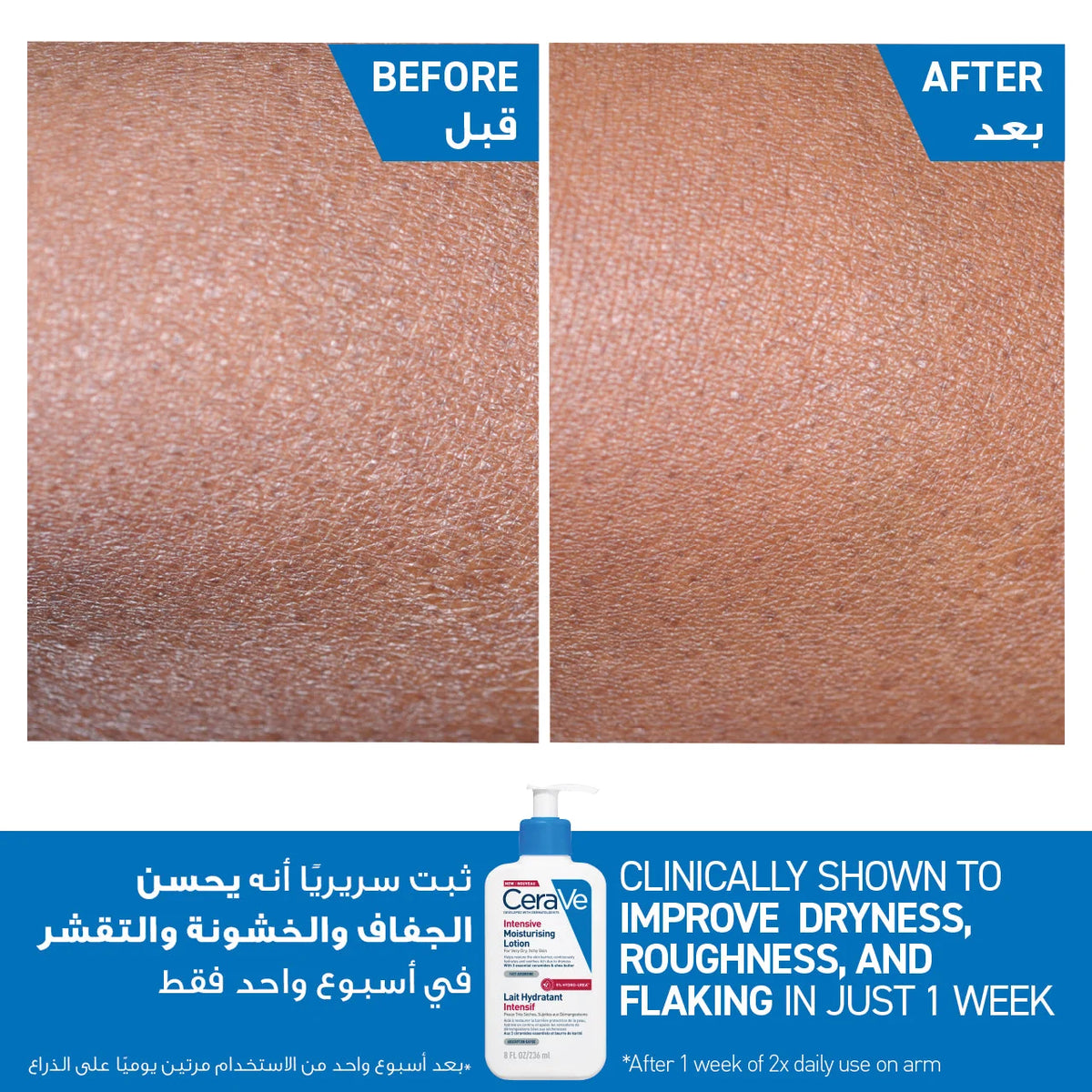 CeraVe Intensive Moisturising Lotion 236ml for Very Dry Skin with Ceramides and Hyaluronic Acid
