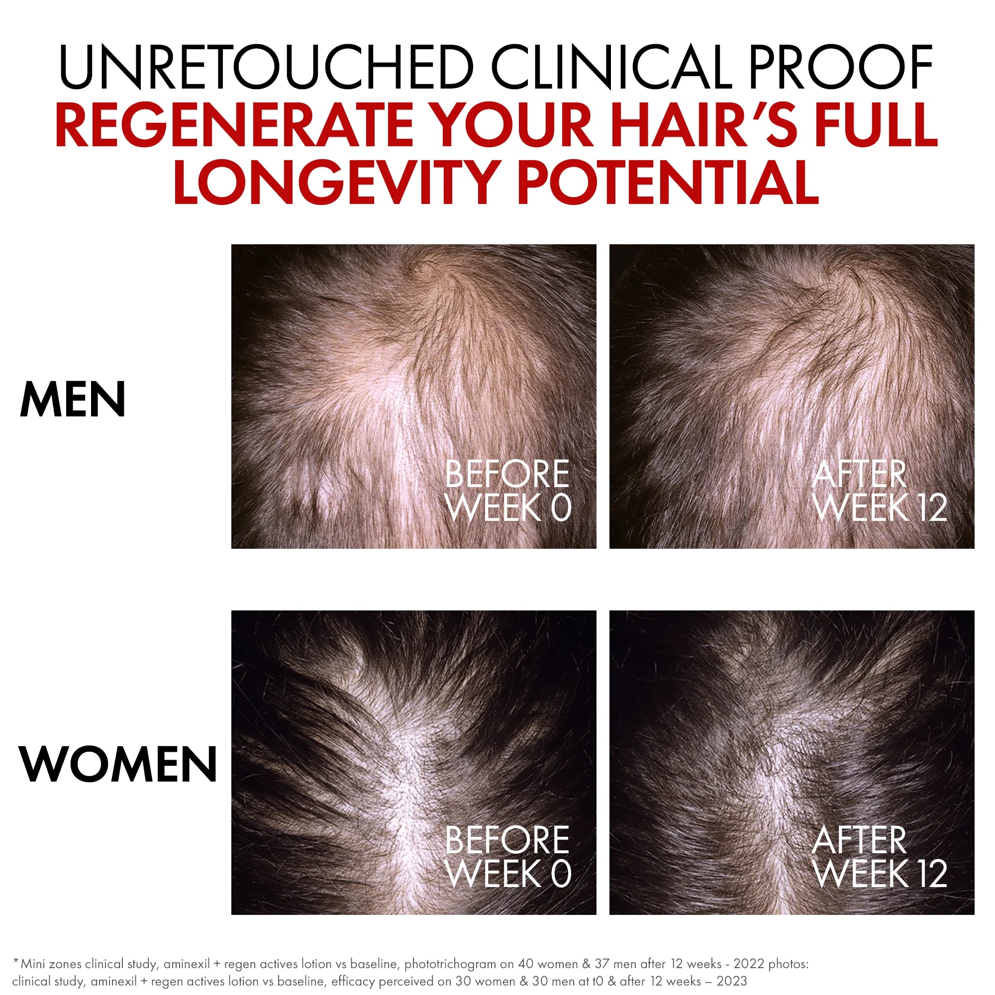 Vichy Dercos Aminexil Clinical R.E.G.E.N. Booster Hair Renewing Serum 90ml for Hair Loss
