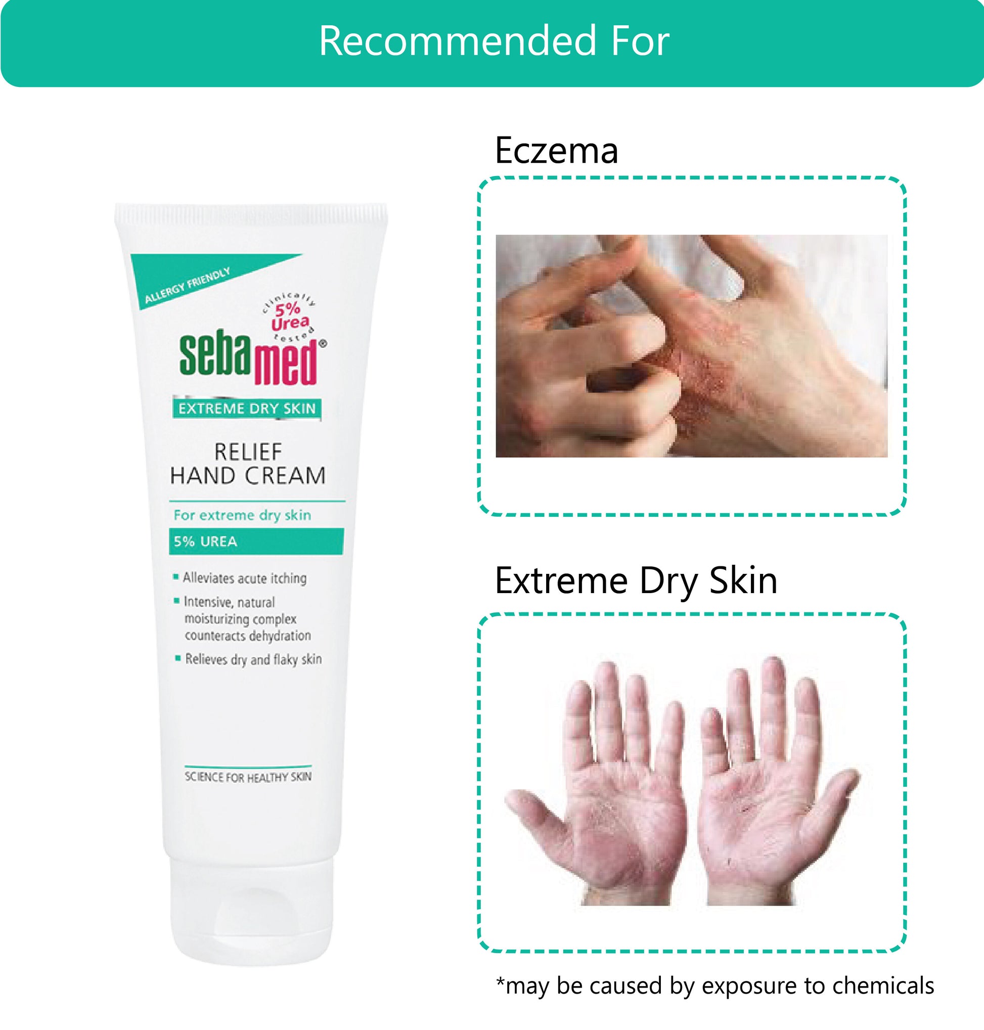 Sebamed Urea Hand Cream 5%-3