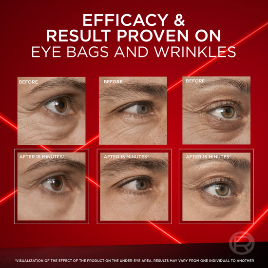 L'Oreal Paris Revitalift Laser Eye Bag Eraser 15ml