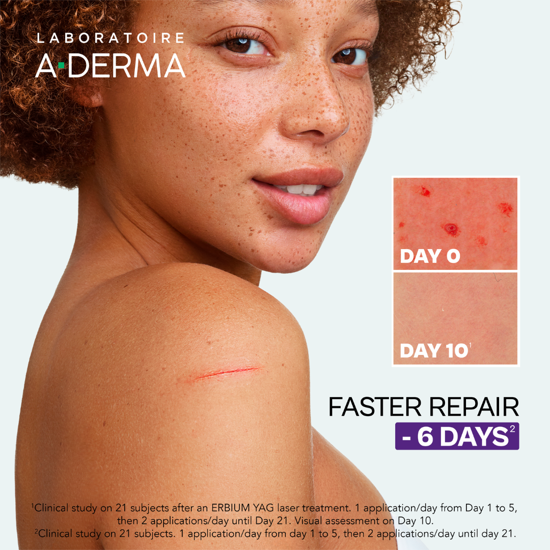 Aderma Epitheliale AH Ultra Anti-mark Repairing Cream and get a FREE 50ml Aderma hand and nails cream
