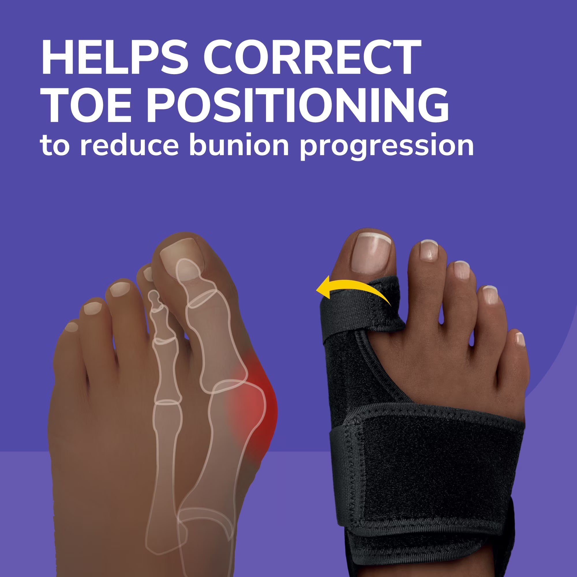 Dr. Scholl's Bunion Relief & Toe Corrector