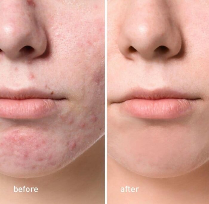 AFRODITA  Pure Skin Solution zno cream-5