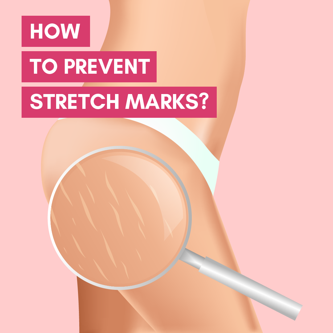 Sebamed Anti Stretch Mark Cream-4