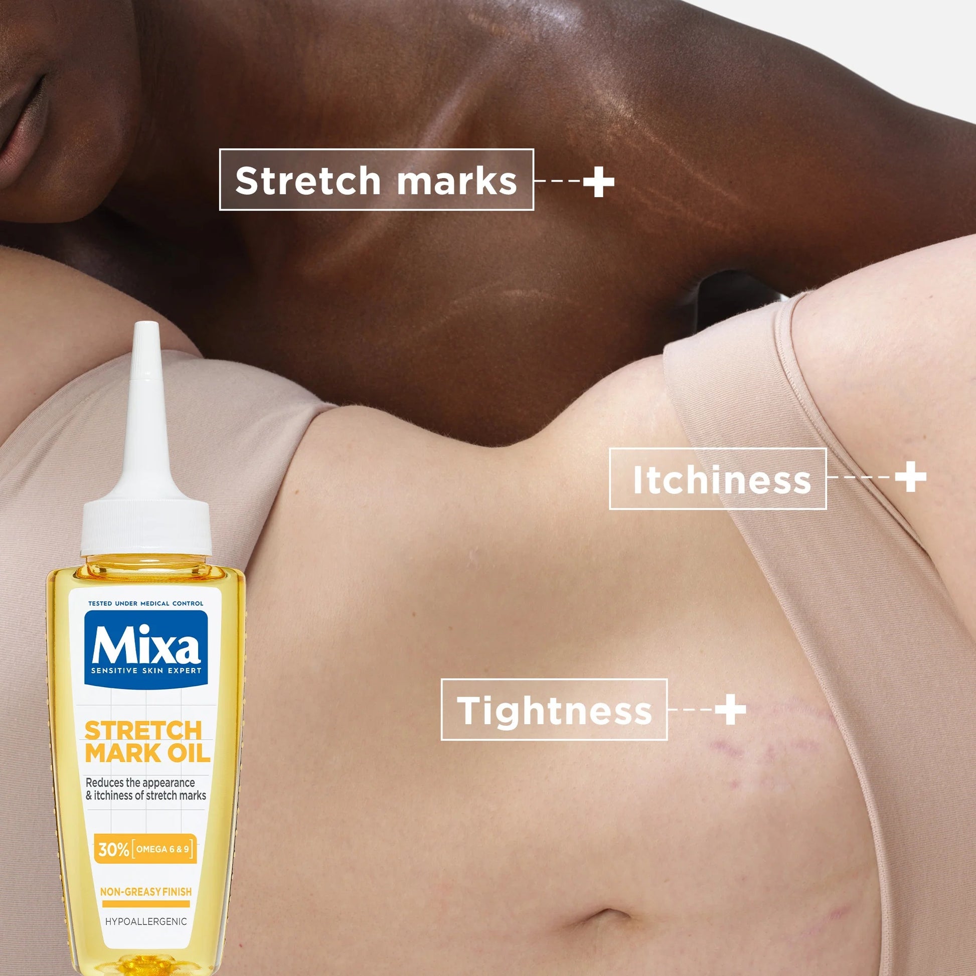 Mixa Stretch Mark Oil 30% Omega 6 & 9-3
