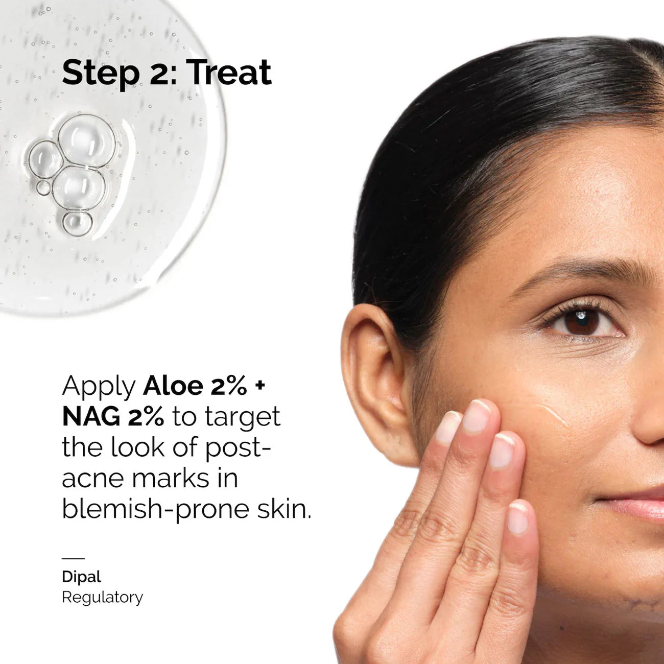 The Ordinary Aloe 2% + NAG 2% Solution 30ml