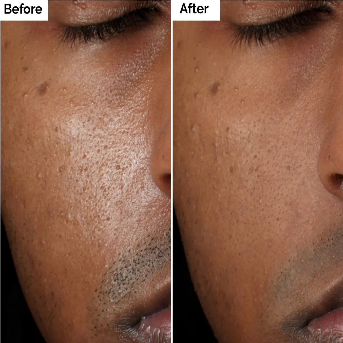 The Ordinary Aloe 2% + NAG 2% Solution 30ml