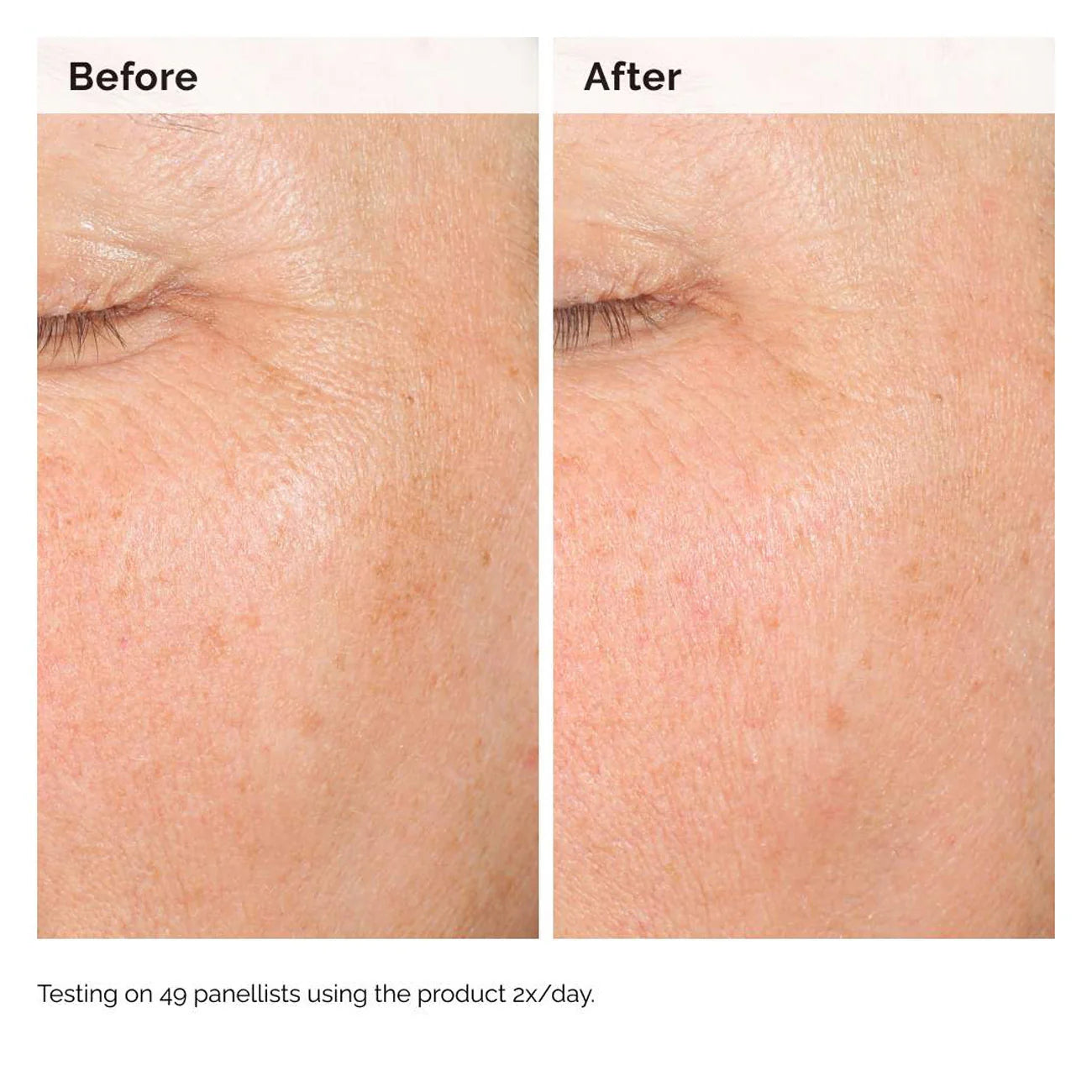 The Ordinary Alpha Arbutin 2% + HA 30ml