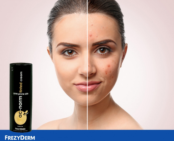 Frezyderm AC Norm Tinted Cream-5
