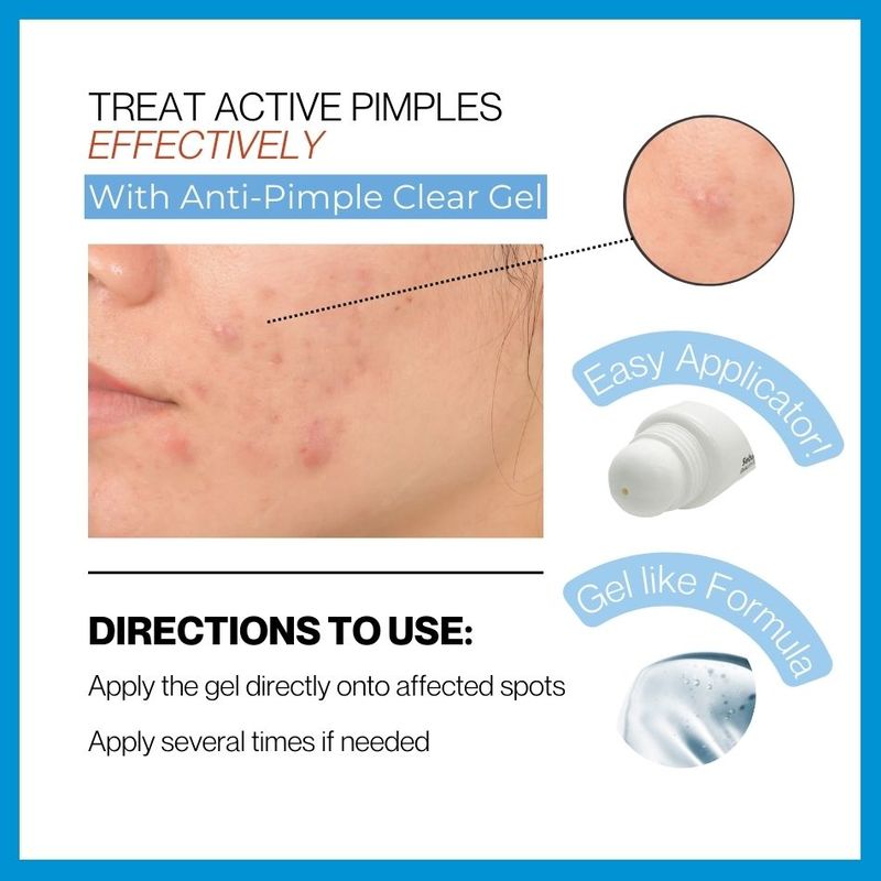 Sebamed Clear Face Anti-Pimple Gel-2