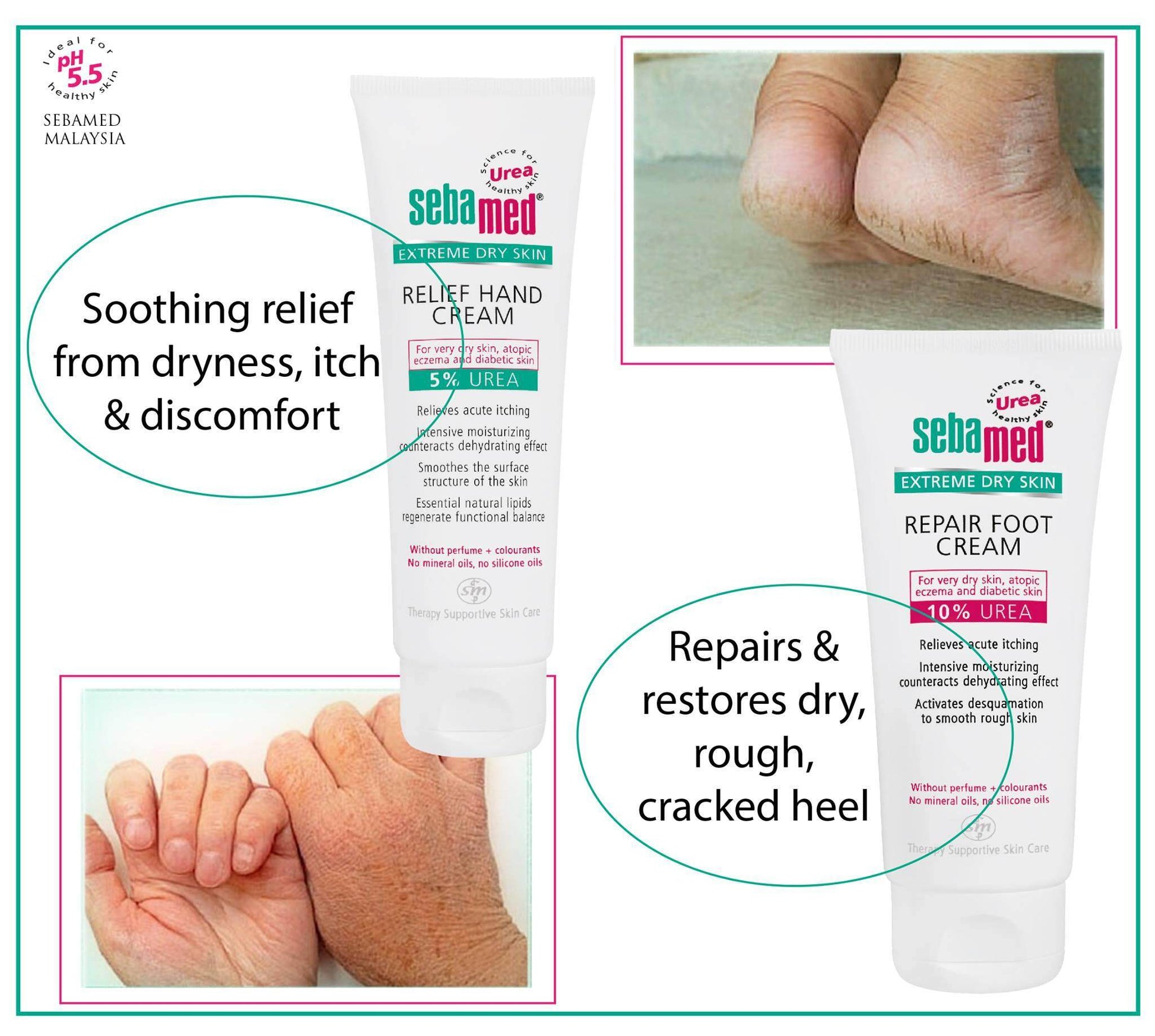 Sebamed Urea Hand Cream 5%-4