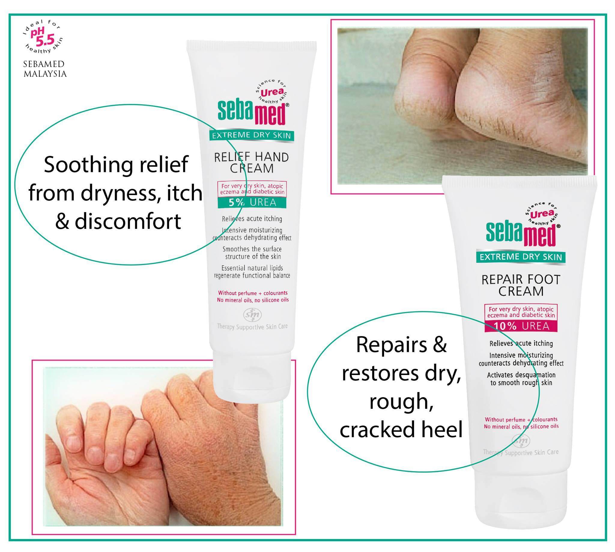 Sebamed Urea Hand Cream 5%-4