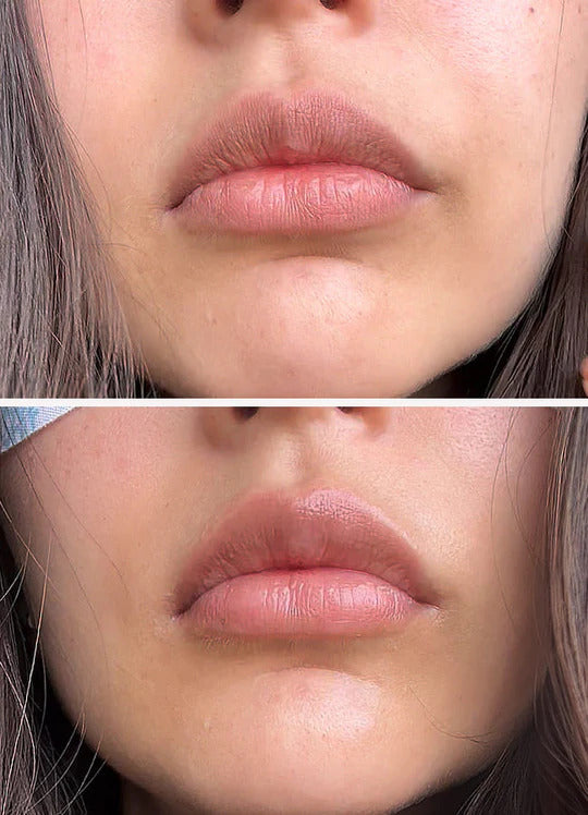 Talika Smile Patch – Hydrating Lip Mask for Soft, Plump Lips-4