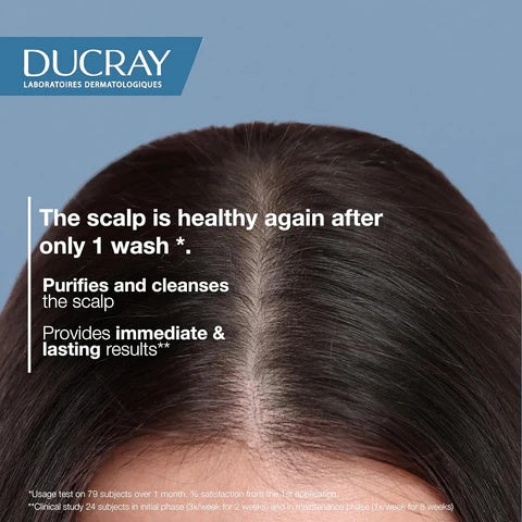 Ducray Kelual Squanorm Regulating Treatment Shampoo for Oily Dandruff-3