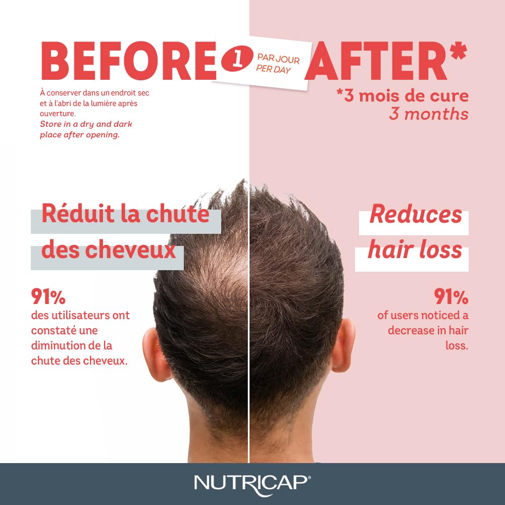 Nutricap Anti Hairloss Serum- Anti-Chute 10 Ampoules (2)-4