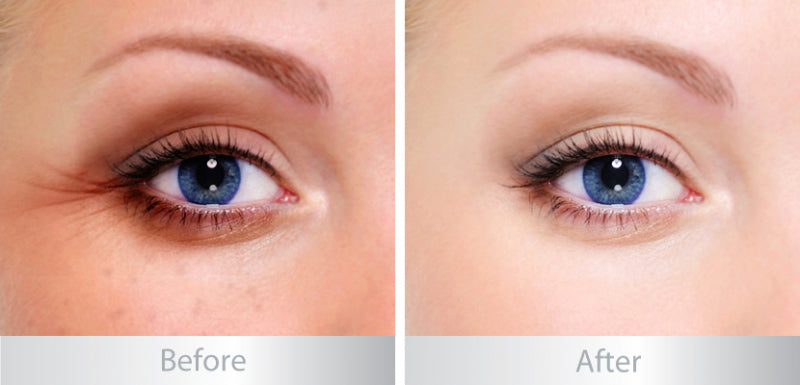 Frezyderm Color Eye Balm- Puffiness & Dark Circles-4