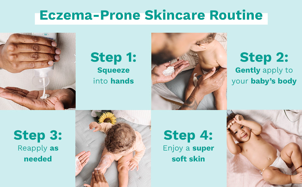 Mustela Stelotopia Emollient Cream - Eczema Prone Skin- 200ml-5