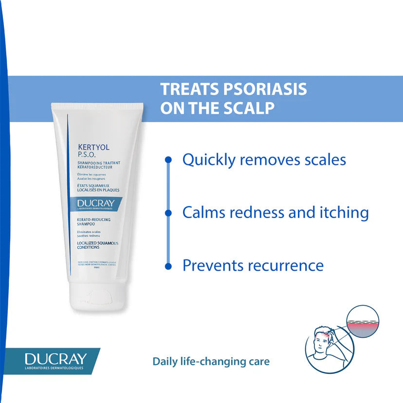 Ducray Kertyol P.S.O. 200 ml  – Targeted Care for Psoriasis-Prone Scalp and Skin-3