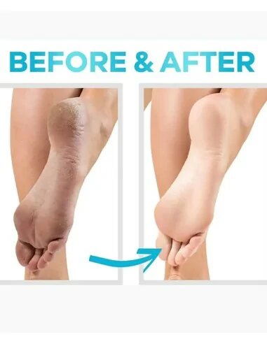 CeraVe SA Renewing foot Cream, SA Crème Pieds Régénérante-5