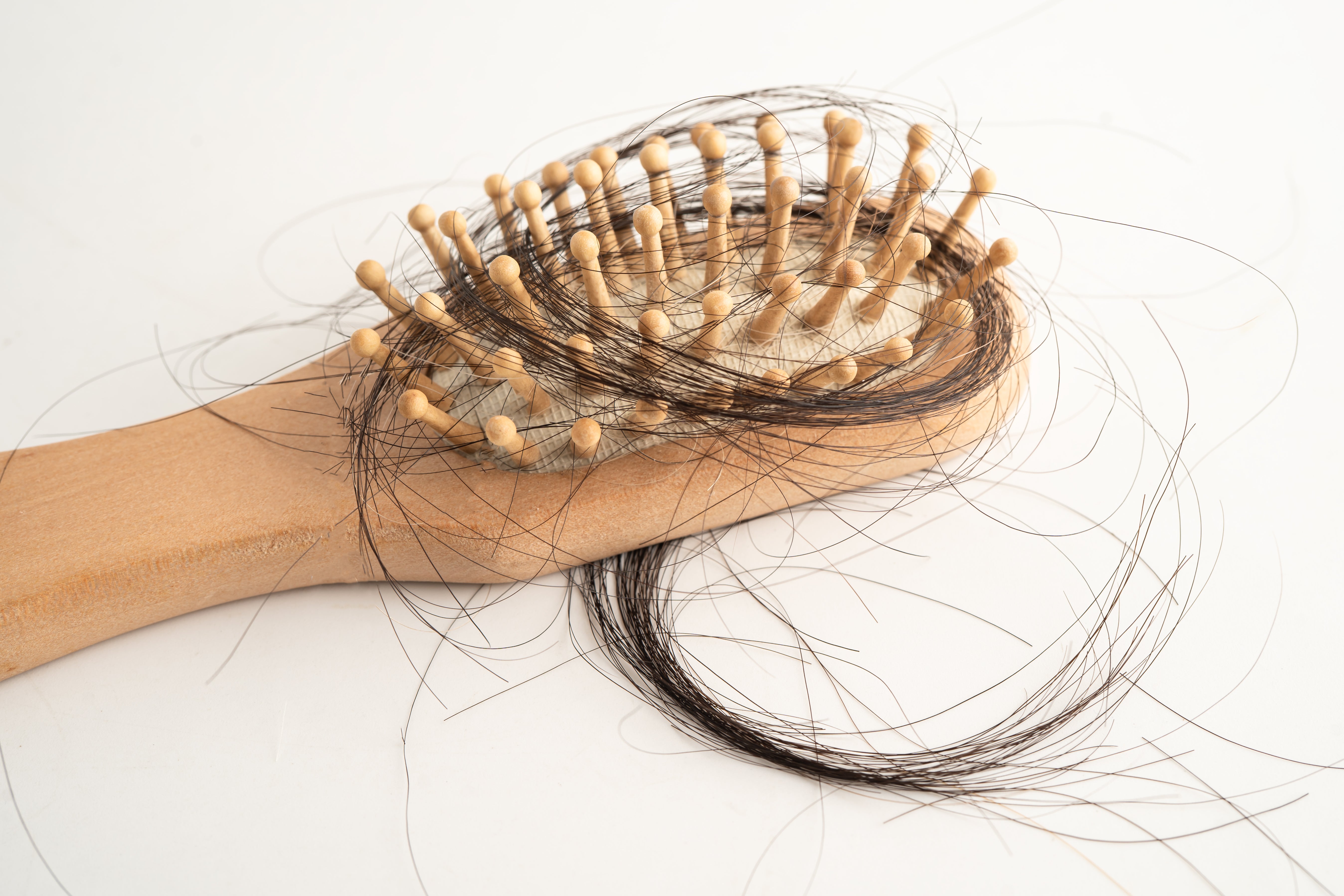 Hair Loss