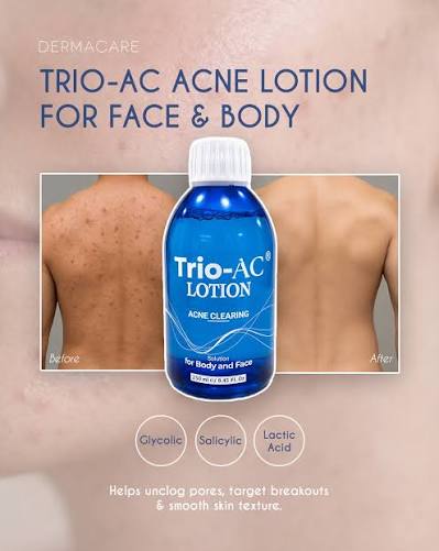 Trio-AC Lotion Acne Clearing