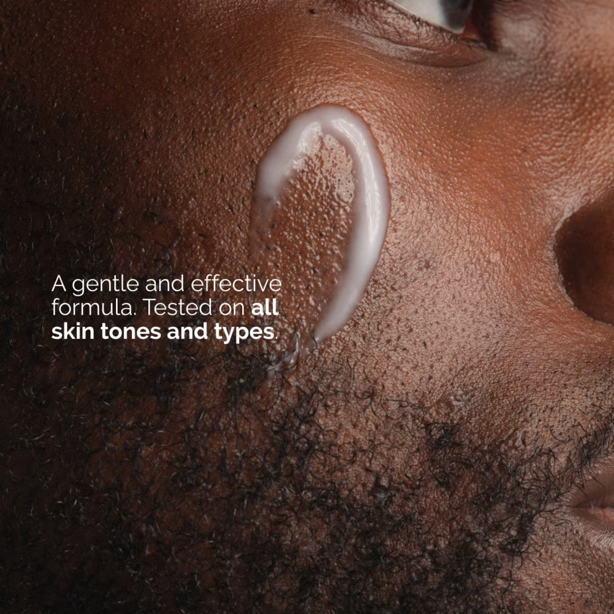 The Ordinary Niacinamide 5% Face & Body Emulsion 100ml