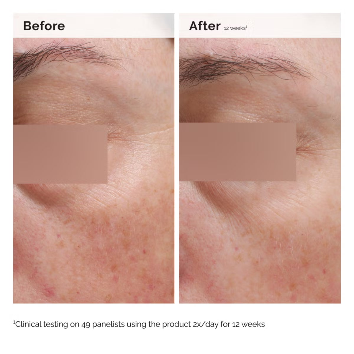 The Ordinary Niacinamide 5% Face & Body Emulsion 100ml